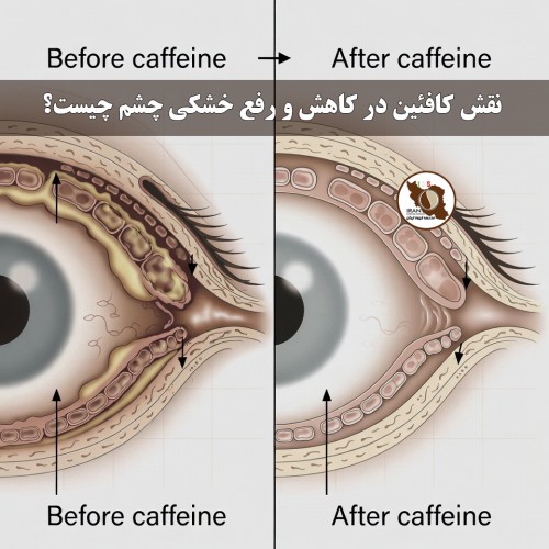 نقش کافئین در کاهش و رفع خشکی چشم چیست؟ | بررسی علمی و کاربردی